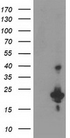 TP73-AS1 antibody