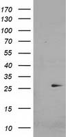 CDKN3 antibody