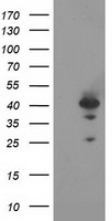 Rad51L1 (RAD51B) antibody