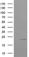 CTBP1-DT antibody