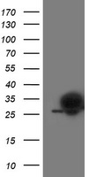 PGAM2 Antibody