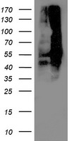 Lipoamide Dehydrogenase (DLD) antibody