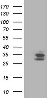 TRAP alpha (SSR1) antibody