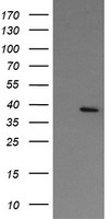 NUDT9 antibody