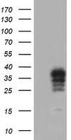 CRALBP Antibody