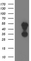 Tropomodulin 1 (TMOD1) antibody
