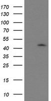 GDAP1L1 antibody