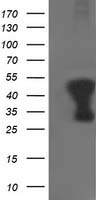 Tropomodulin 1 (TMOD1) antibody