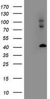 LMCD1 Antibody