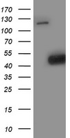 Spermine synthase (SMS) antibody