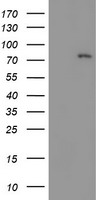 LIM Kinase 1 (LIMK1) antibody