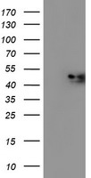 NDUFAF7 Antibody