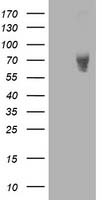 LIM Kinase 1 (LIMK1) antibody