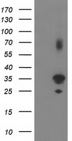 PLEKHA3 Antibody