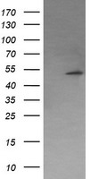 PPM1B antibody