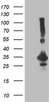 PNMT antibody