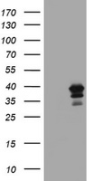 MAGEB18 antibody