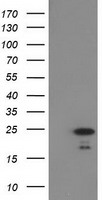 HDHD1A (PUDP) antibody