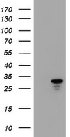 HDHD1A (PUDP) antibody