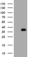 MAGEB18 antibody