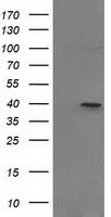 PIH1D2 antibody