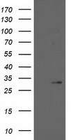 Prostaglandin dehydrogenase 1 (HPGD) antibody