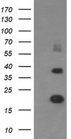 Malignant T cell amplified sequence 1 (MCTS1) antibody