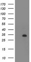 Tristetraprolin (ZFP36) antibody