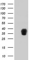 Tristetraprolin (ZFP36) antibody