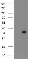 PIH1D2 antibody