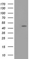 TASP1 antibody