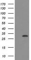 CTDSP1 antibody