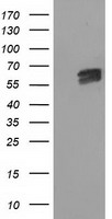 EXDL1 (EXD1) antibody