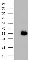 LRATD2 antibody