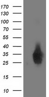 DUSP27 (DUPD1) antibody