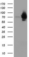 HSPA6 antibody
