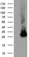 Glutathione S Transferase theta 2 (GSTT2) antibody