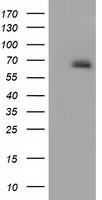 alpha 1 Fetoprotein (AFP) antibody