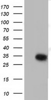 SULT2A1 antibody