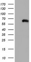 CORO1B antibody