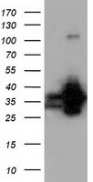 QPRT antibody