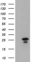 LIN7 (LIN7B) antibody