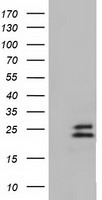 Ephrin A2 (EFNA2) antibody