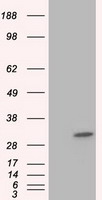 ketohexokinase (KHK) antibody