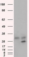 GNMT antibody