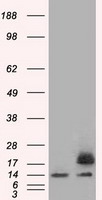 Profilin 1 (PFN1) antibody