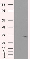 PIM2 antibody