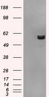 ATP5F1B antibody