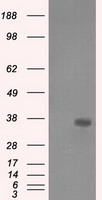 AKR1A1 antibody