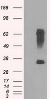 IBRDC2 (RNF144B) antibody